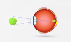 troubles-visuels-astigmate